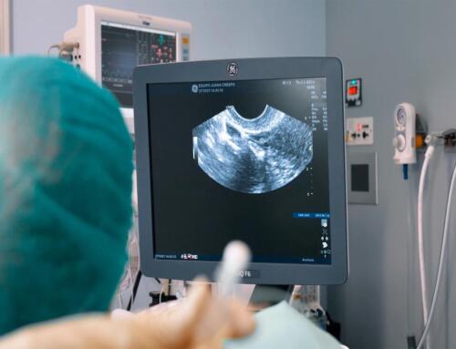 How to determine endometrial receptivity